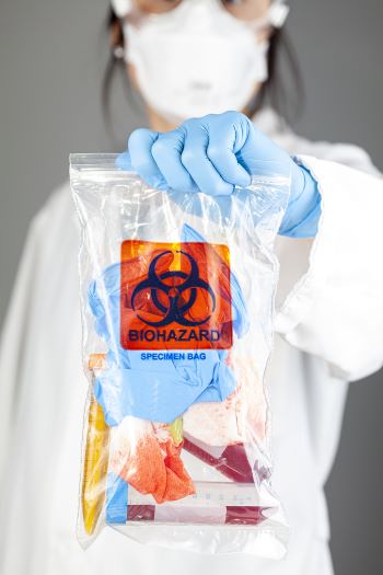 A woman researcher is holding a clear plastic bag with biohazard logo printed on. The bag contains, potentially dangerous biological specimens. 