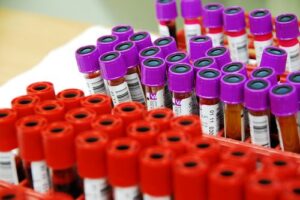 Blood samples that will require medical waste disposal in a Florida blood bank