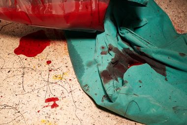 Floor of medical facility is dirty with blood and sutures.